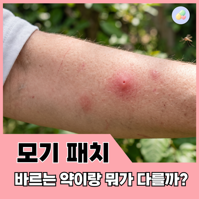 모기 물린 데 붙이는 패치도 괜찮을까? 버물리 플라스타 vs 물린디 플라스타 선택법