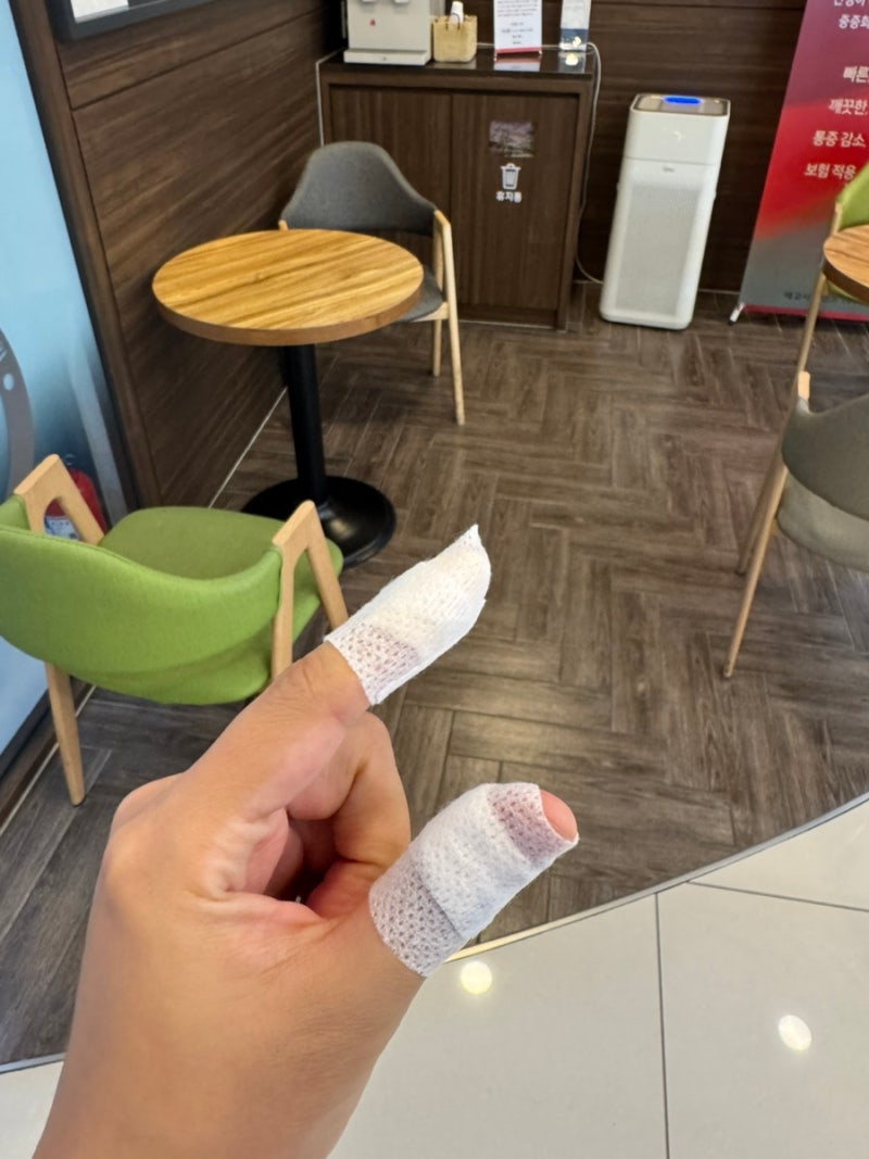 손가락화상 일산화상전문병원 안하던 걸 하면 이렇게 되는건가요? 화상엔딩으로 끝난 효녀....