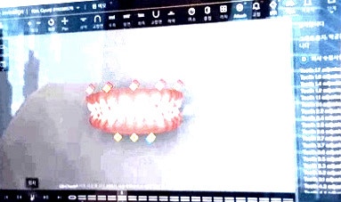 어금니 잇몸 염증 3년 반복하다가 방향 바꾼 후기 (30대 후반 직장인 기록)