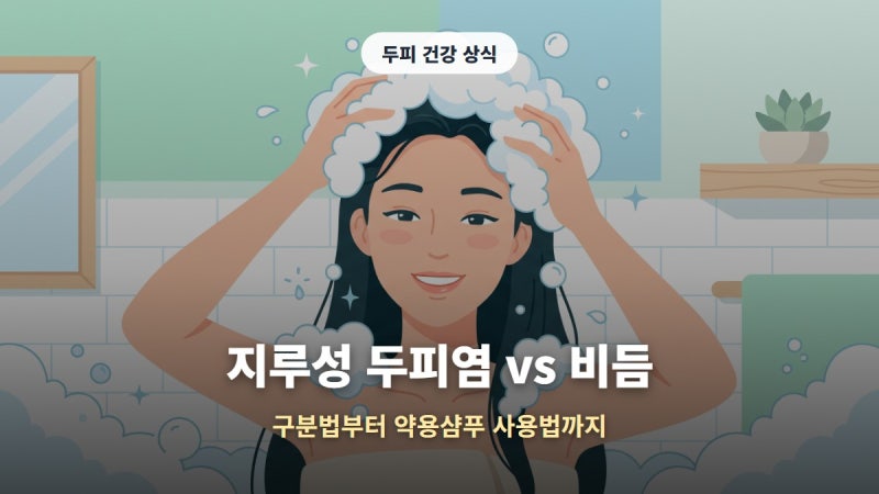 지루성 두피염 vs 비듬 구분법, 약용샴푸 사용법부터 탈모 관계까지