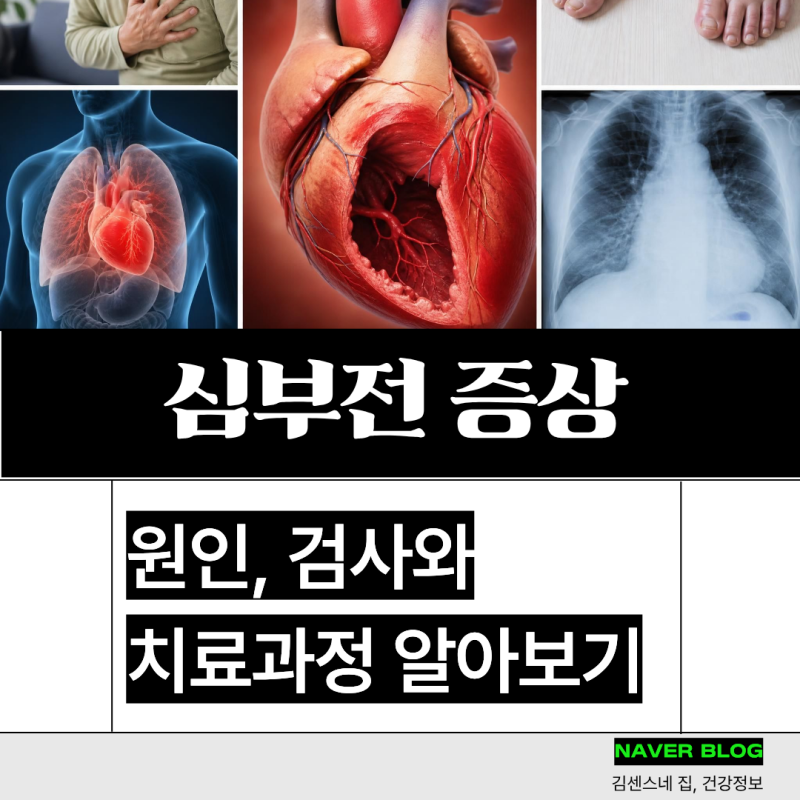 심부전 증상 뜻, 원인 검사와 치료
