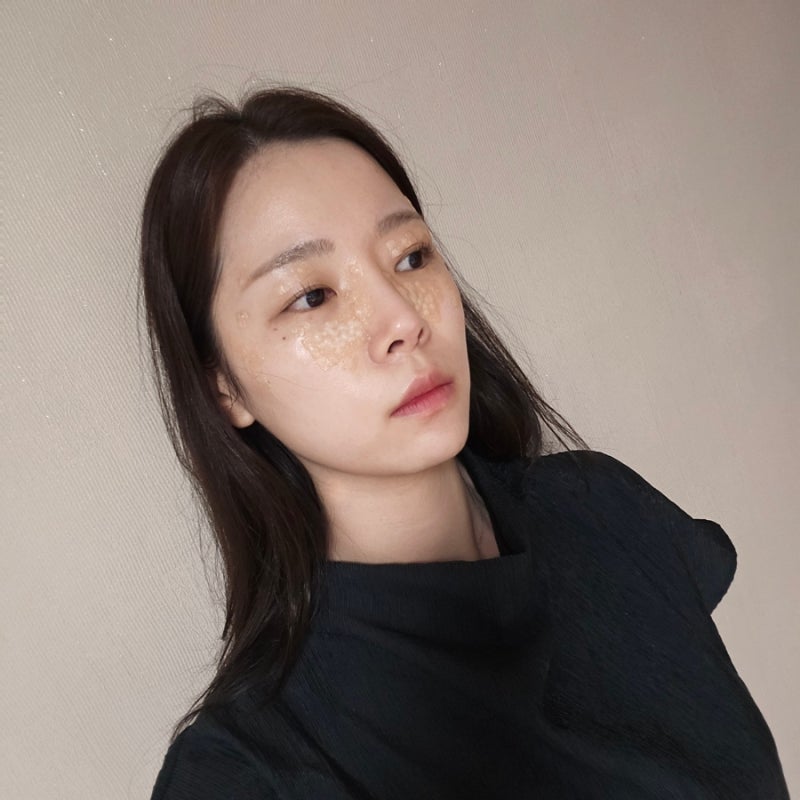 얼굴 편평사마귀 제거 후기 | 제거 후 관리, 편평사마귀 연고 추천