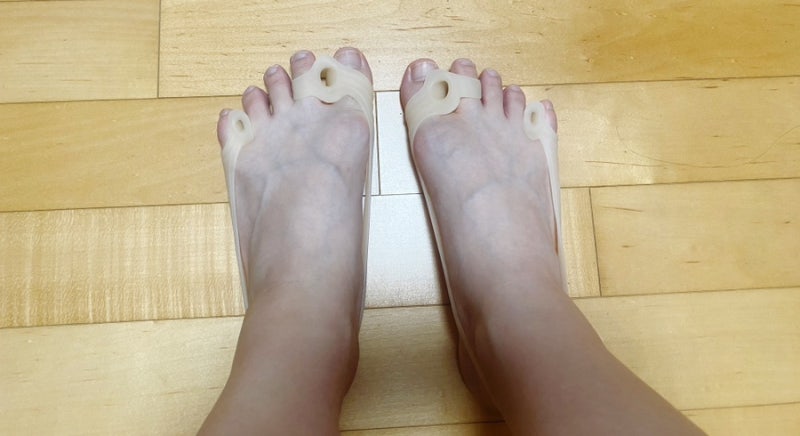 케어릭스 무지외반증교정기 발가락교정기 착용 후기