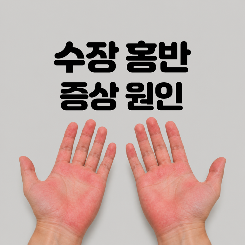 그냥 넘기면 안 되는 간과 호르몬의 경고, 수장 홍반 증상 원인 치료법