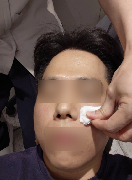 [2회차] 서울 강남역/신논현역 피부과 스킨부스터 리쥬란 2cc 정품 포인트 받고 시술 후기까지....