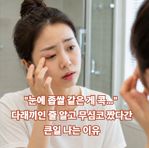 "눈에 좁쌀 같은 게 콕…" 다래끼인 줄 알고 무심코 짰다간 큰일 나는 이유