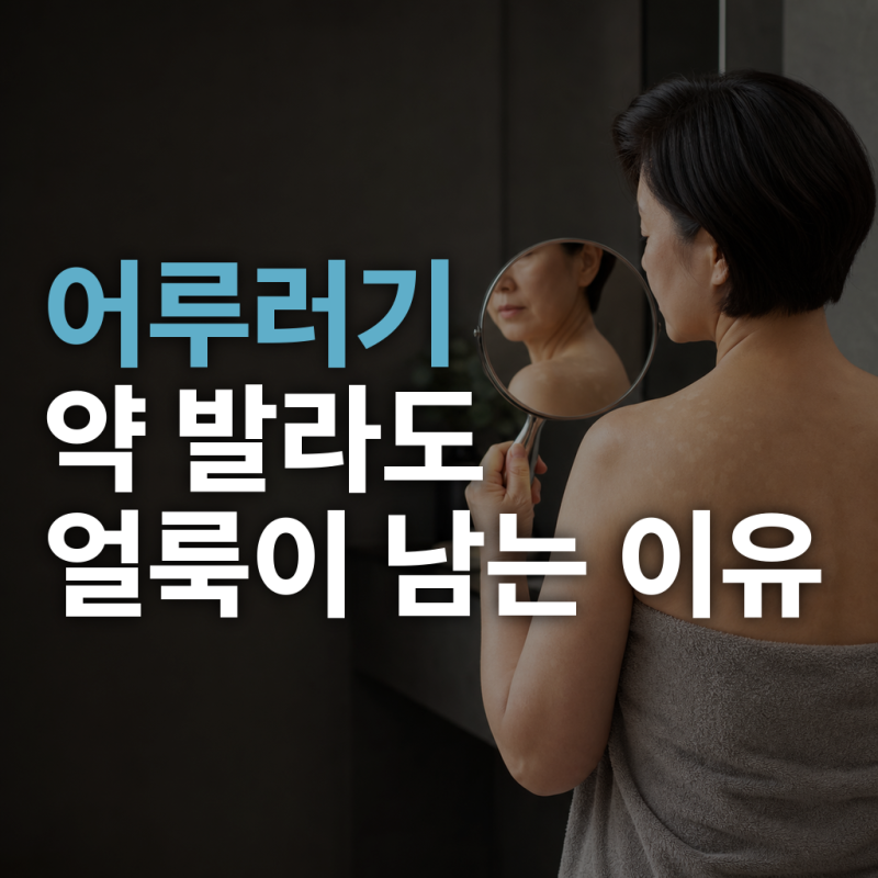 어루러기, 약 발라도 하얀 얼룩이 남는 이유