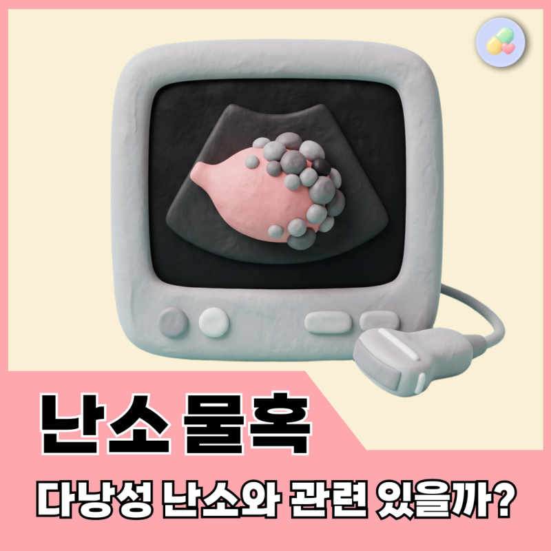초음파에 난소 물혹이 많대요, 저 다낭성인가요? (2023 가이드라인 핵심 정리)