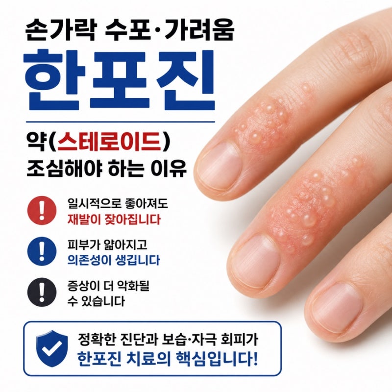 손가락 수포 가려움 한포진 약 스테로이드 조심해야 히는이유