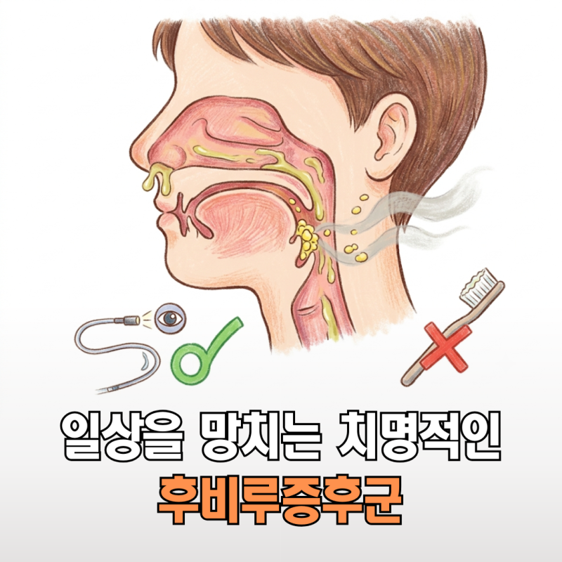 후비루증후군 방치하면 구취 폭발? 편도결석을 유발하는 끈적한 콧물의 진실