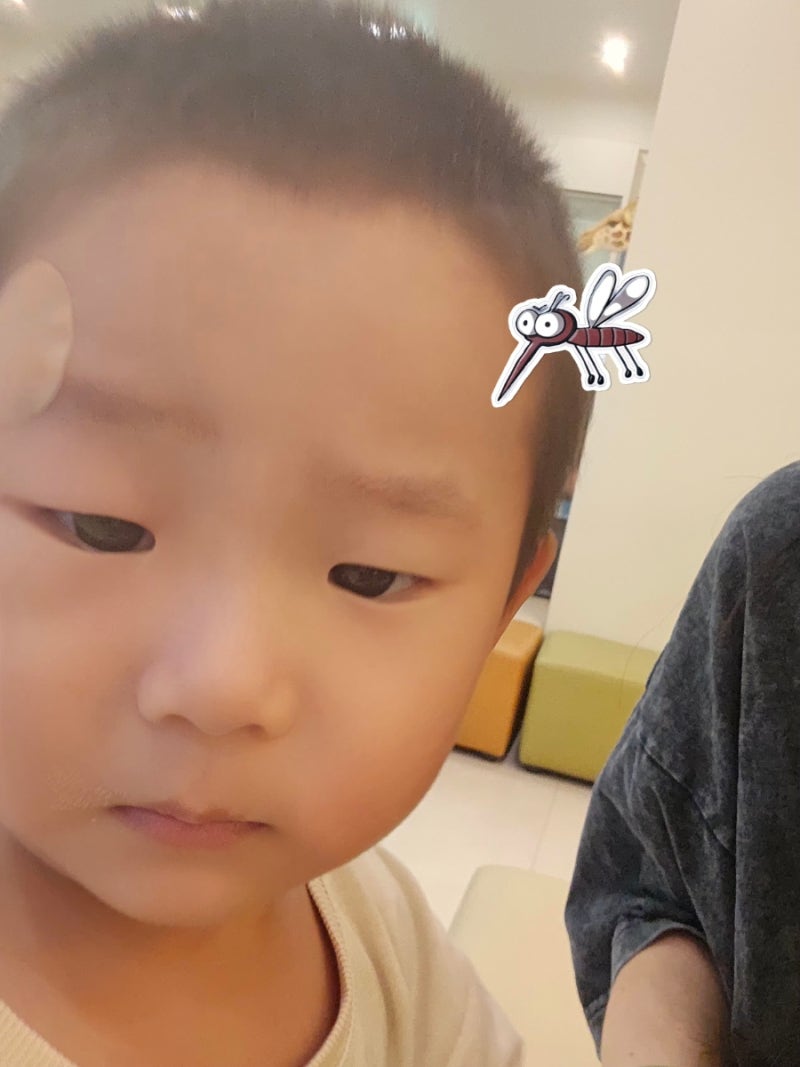 아기 모기 물렸을 때 눈이 퉁퉁? 아기 모기 알러지 스키터증후군 여름철 대처템 총정리