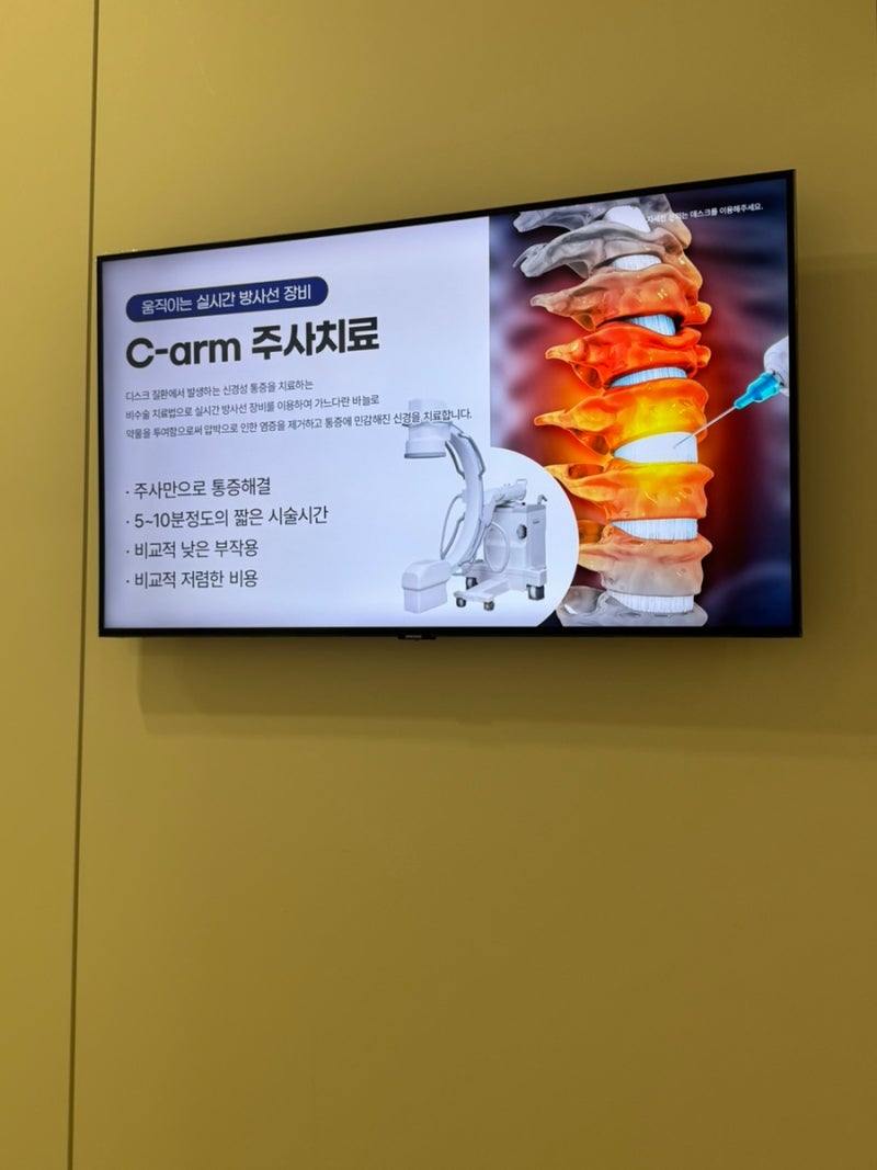C-arm 신경차단술 후기｜목·어깨 통증 주사 효과, 부작용, 10개월 후 재시술 리얼후기 (QnA포함)