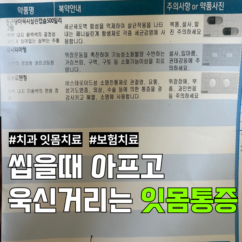 가만히 있어도 잇몸이 아플 때!! 잇몸 치료 및 처방약 복용 후기 (비용, 치료 통증 후기 포함)