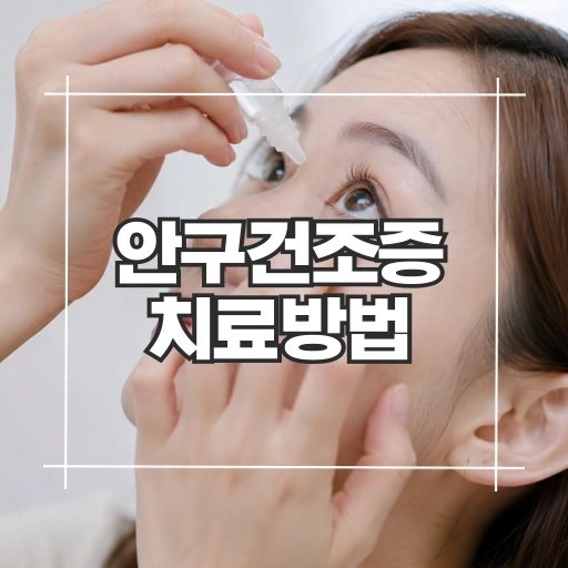 안구건조증 치료 방법, 어떻게 관리해야 눈이 편안해질까요?