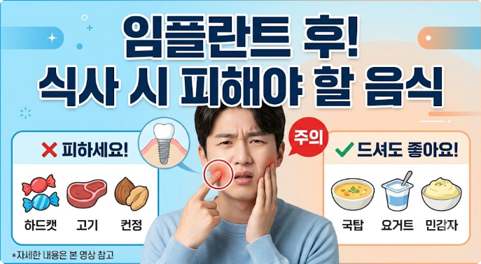 임플란트 후 식사 시 피해야 할 음식