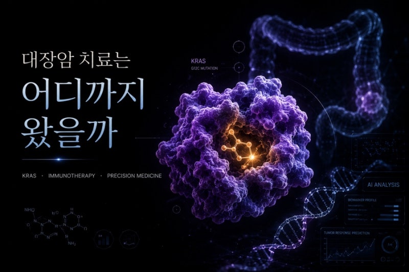 대장암(Colorectal Cancer)