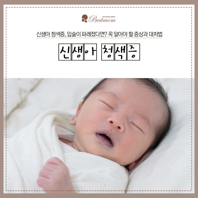신생아 청색증, 입술이 파래졌다면? 꼭 알아야 할 증상과 대처법