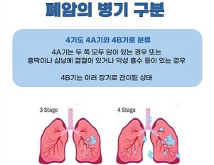 폐암 4기 환자는 호스피스 병동 이용 가능