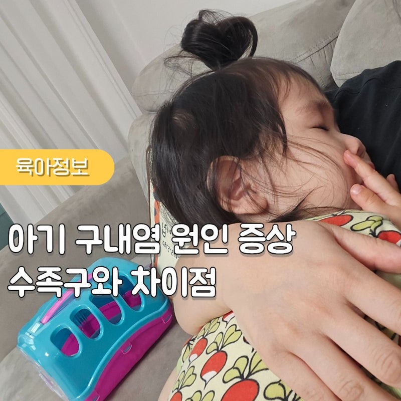 아기 구내염 원인 증상 열 수족구와 차이점