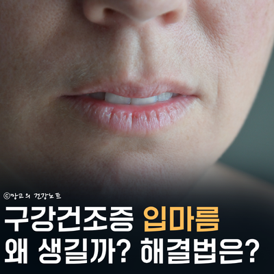 구강건조증 입마름 증상 왜 생기나요?ㅣ원인 해결법