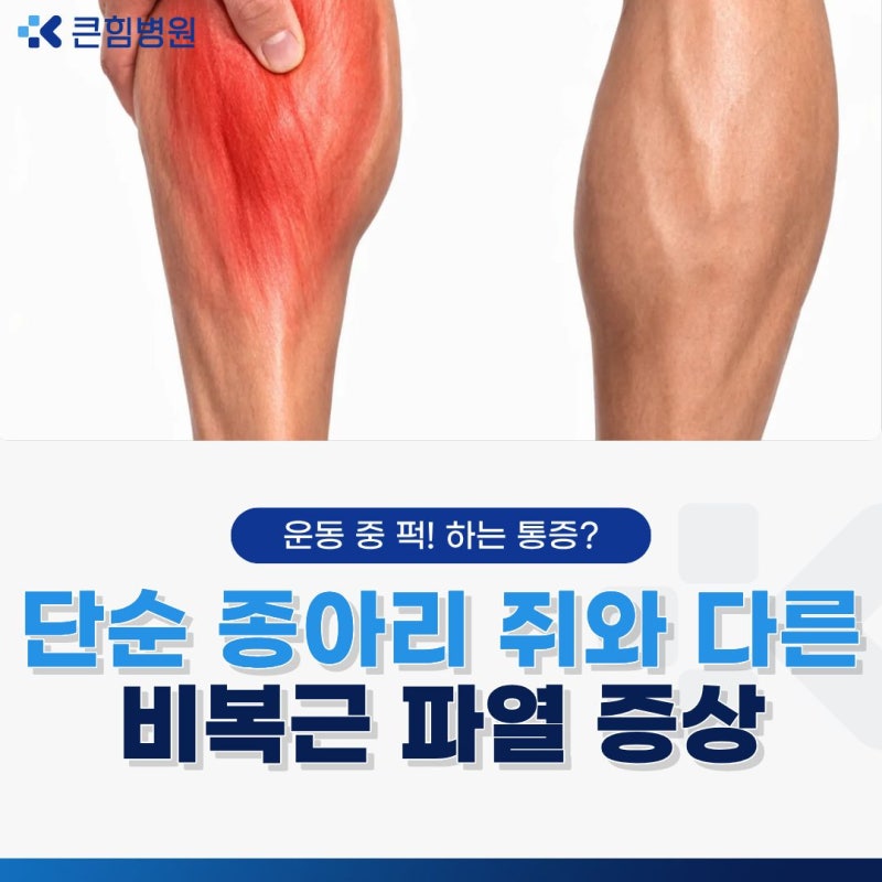 부산진구정형외과에서 확인하는 비복근 파열