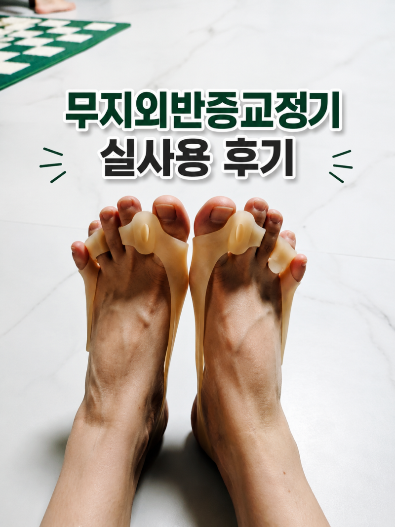 무지외반증교정기 사용 후기 실리콘 발가락교정기 케어릭스 리얼 리뷰