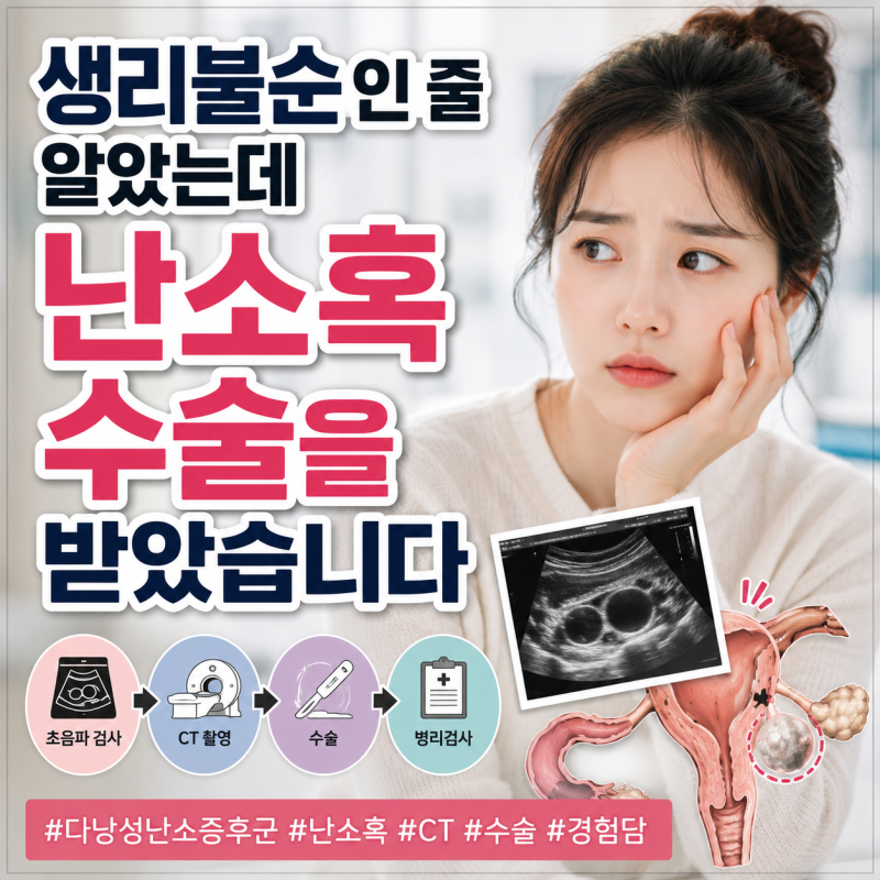 생리불순인 줄 알았는데 다낭성난소증후군 난소혹 수술까지