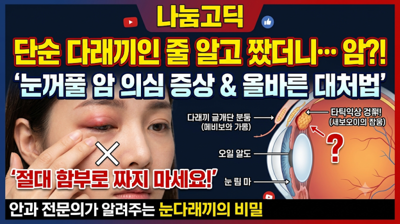 "단순 다래끼인 줄 알고 짰는데…" 눈꺼풀 암 신호일 수 있는 의심 증상