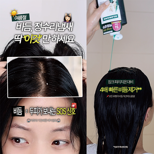 지루성두피염 비듬샴푸 추천, 올리브영 클로란 갈랑가 지성 샴푸 후기