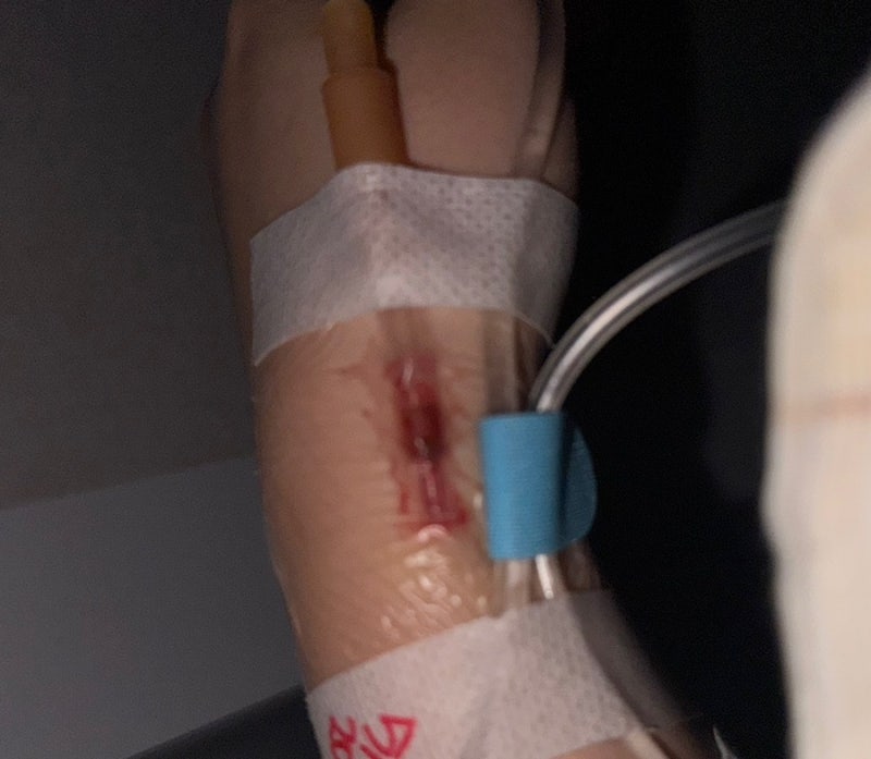 허리수난기① ] 허리디스크 터져서 풍선확장술 받고 온 눈물의 입원 후기 1탄 ㅠㅠ (부제: 병....