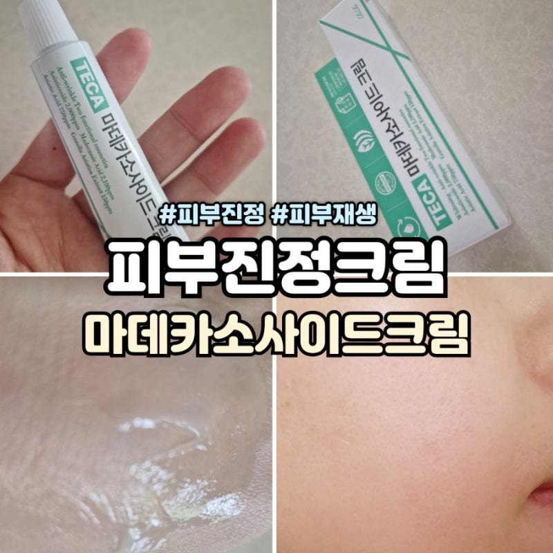 피부진정크림 연고타입 마데카소사이드 크림 필수템