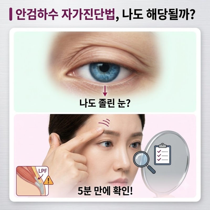 이마 보톡스 맞고 눈이 자꾸 무거워요… 안검하수 자가진단법 나도 해당될까?