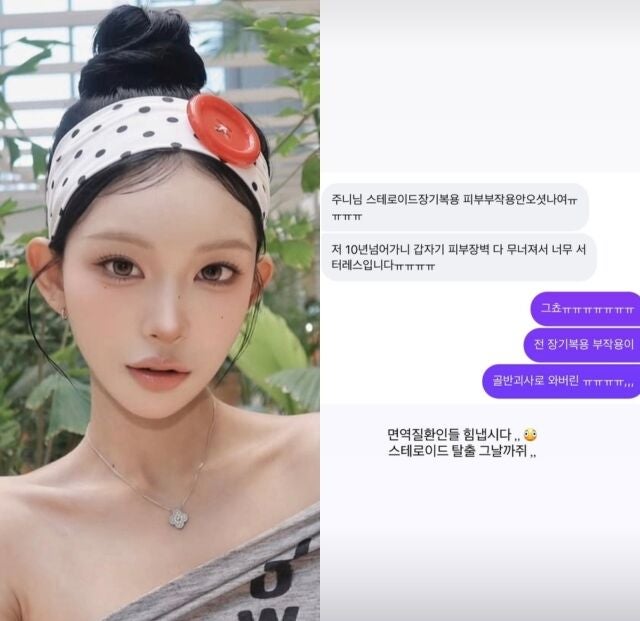 최준희, 스테로이드 부작용으로 골반 괴사 진단