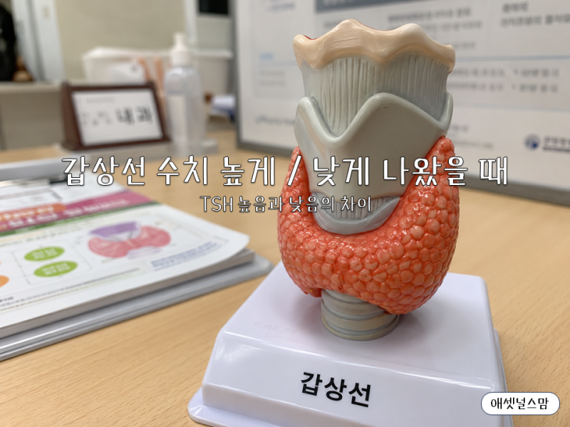 갑상선 수치 TSH 높음 낮음, 건강검진 결과표 그냥 넘기면 안 되는 이유
