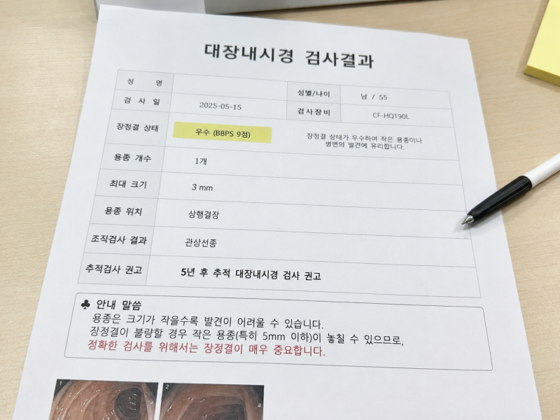 대장 선종 여러 개 나왔다면 더 위험할까? 개수별로 보는 법