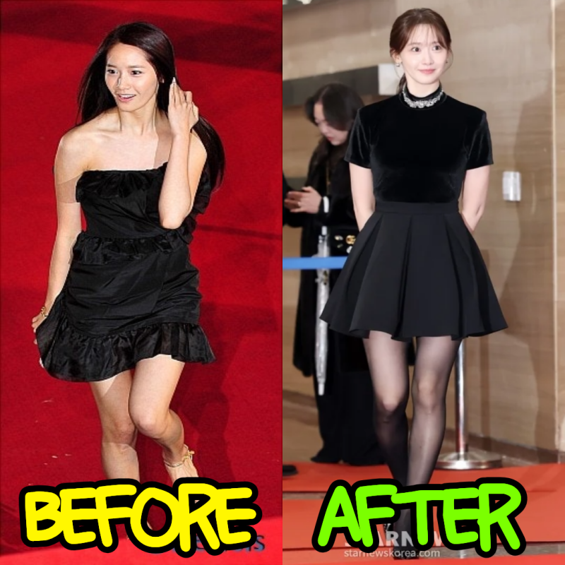 데뷔 초 심한 오다리였던 윤아, 어떻게 지금의 일자 다리가 됐을까?