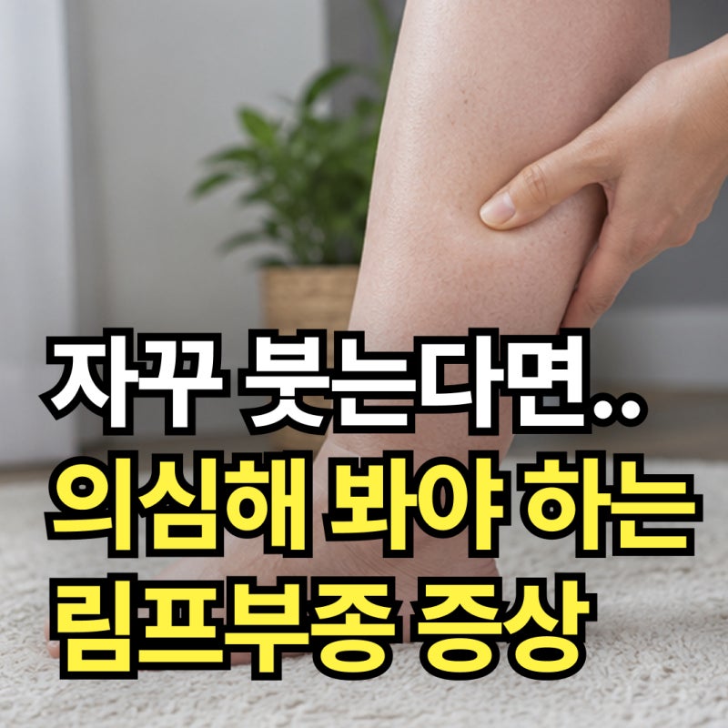 "자꾸 팔 다리가 붓는다면..." 림프부종 원인, 자가진단 체크리스트와 증상!