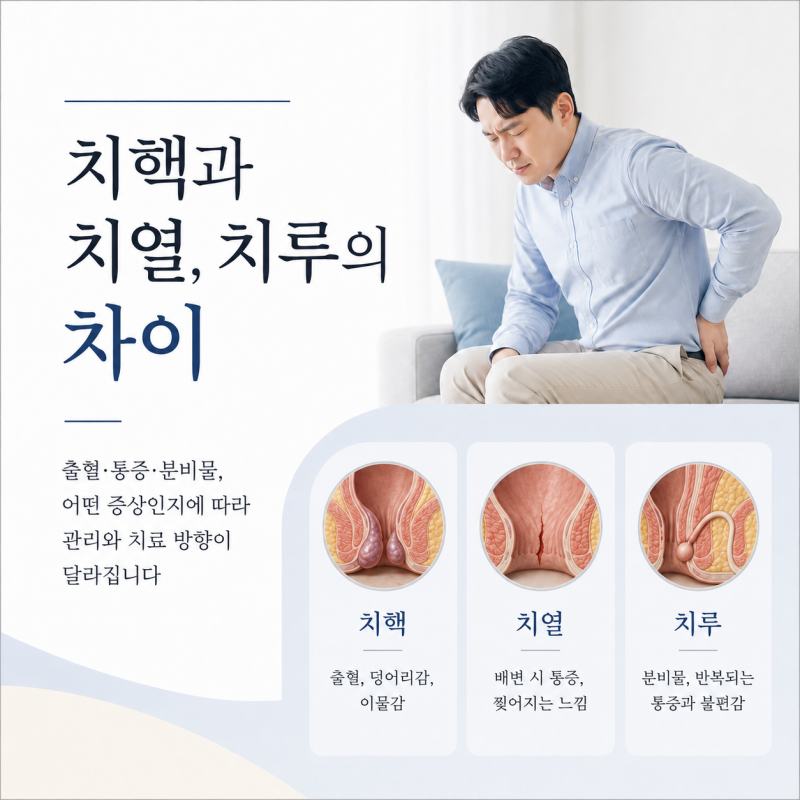 치핵과 치열, 치루의 차이까지 한 번에 정리