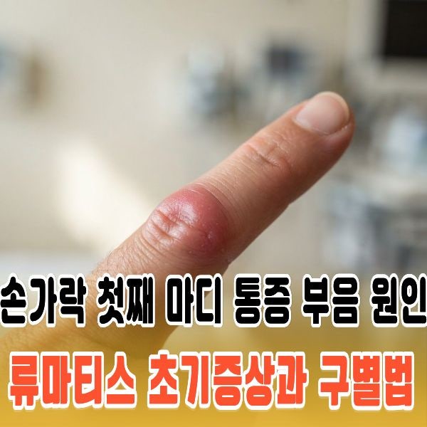 손가락 첫째 마디 통증과 부음 원인, 류마티스 초기증상과 구별법