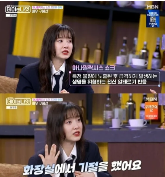 구혜선 드라마 하차 이유, 대부분 음식에 알레르기 반응 나타났다