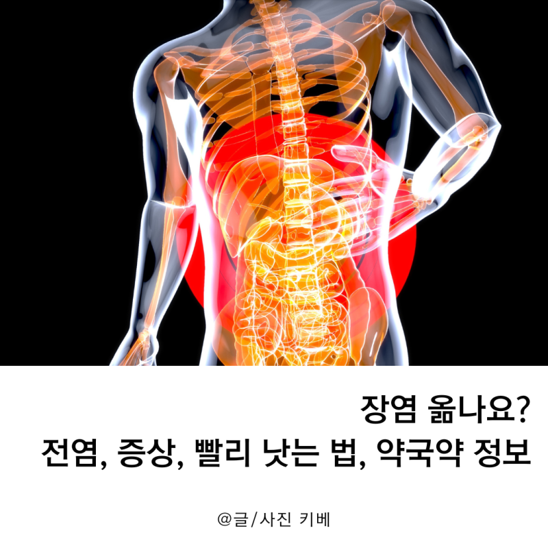 장염 옮나요? 전염, 증상, 빨리 낫는 법, 약국약 정보
