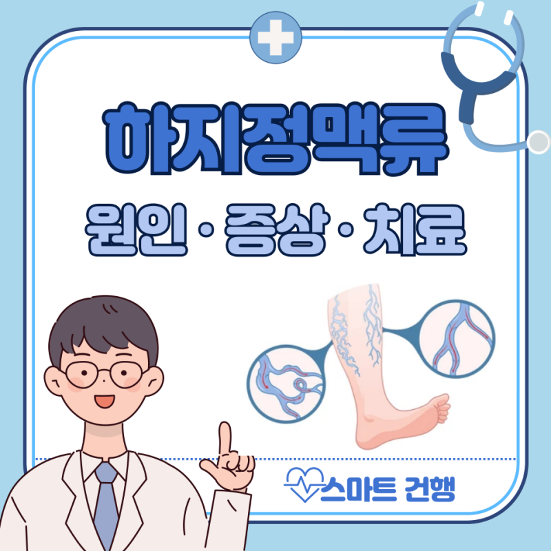 하지정맥류 초기 증상, 치료, 수술 방법 : 통증 부위