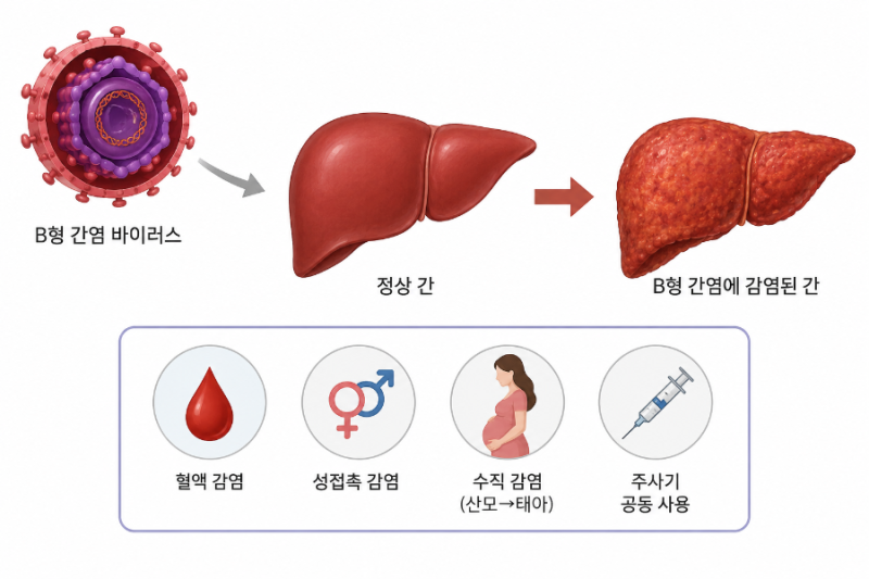 "간암의 가장 큰 원인 중 하나, B형간염! 백신 맞아도 항체가 안 생길 수 있다?" B형간염의 증....