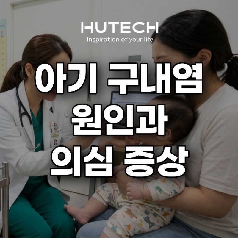 [휴테크 LIFE] 아기 구내염 원인과 의심 증상