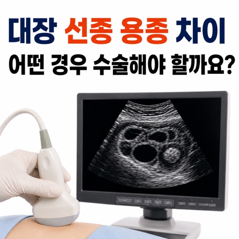 대장 선종 용종 차이 어떤 경우 수술해야 할까요?