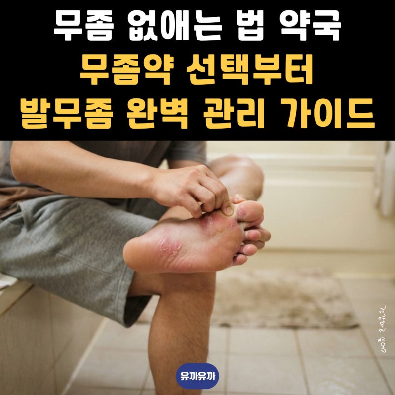 무좀 없애는 법 약국 무좀약 선택부터 발무좀 완벽 관리 가이드
