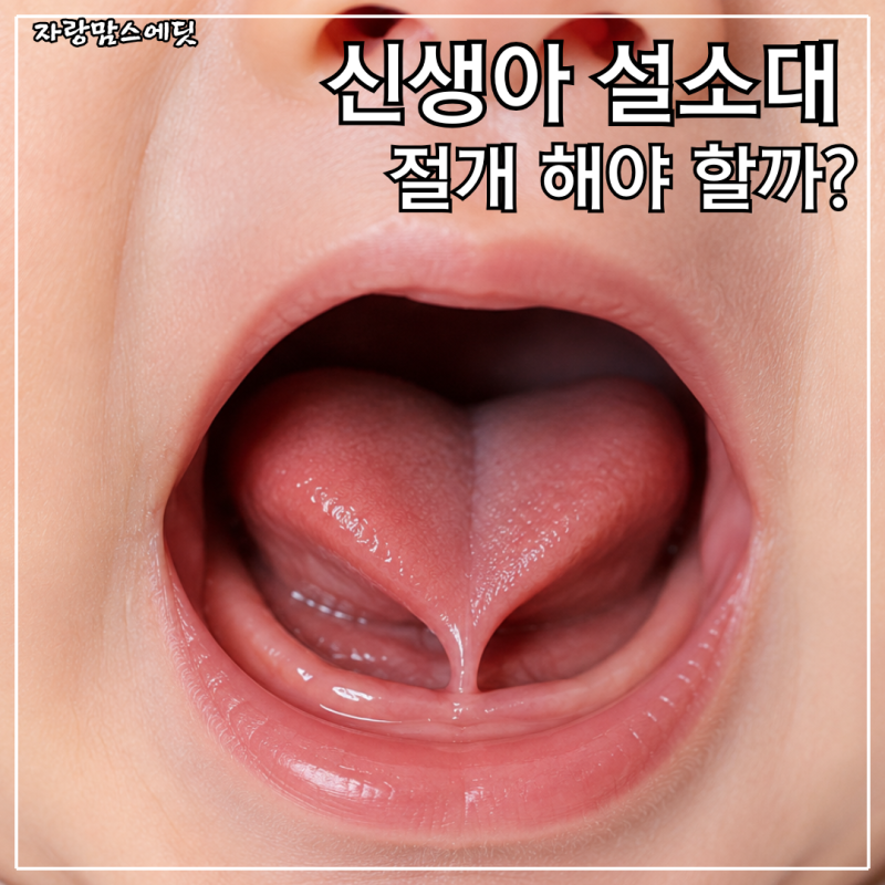 신생아 설소대 수술 꼭 해야 할까?｜설소대 단축증 수술 시기·증상 총정리