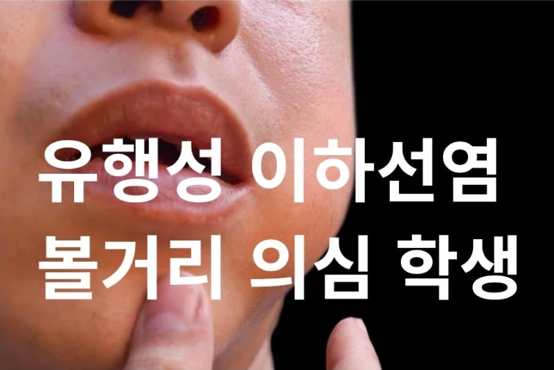 2급 법정감염병 유행성 이하선염 볼거리 의심 학생 바로 병원에 보낸 이유