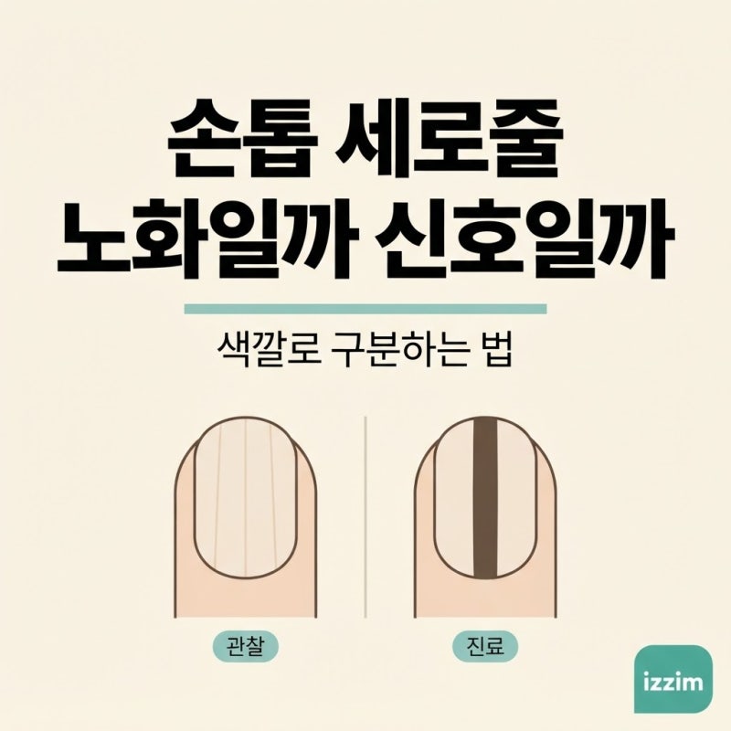 손톱 세로줄, 노화일까 이상 신호일까 ｜ 색깔로 구분하는 법 총정리