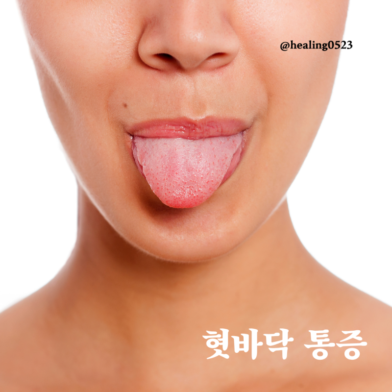 혓바닥 통증 진료과 어디로 가야할까?